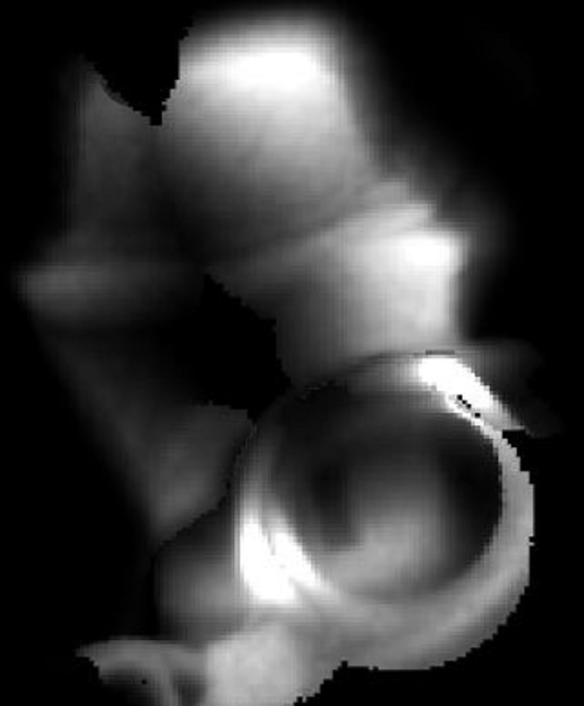 milling a frac plug 2D xray image